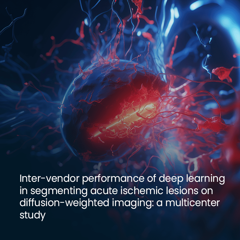 Exploring Inter-Vendor Performance in Acute Ischemic Lesion Segmentation Using Deep Learning