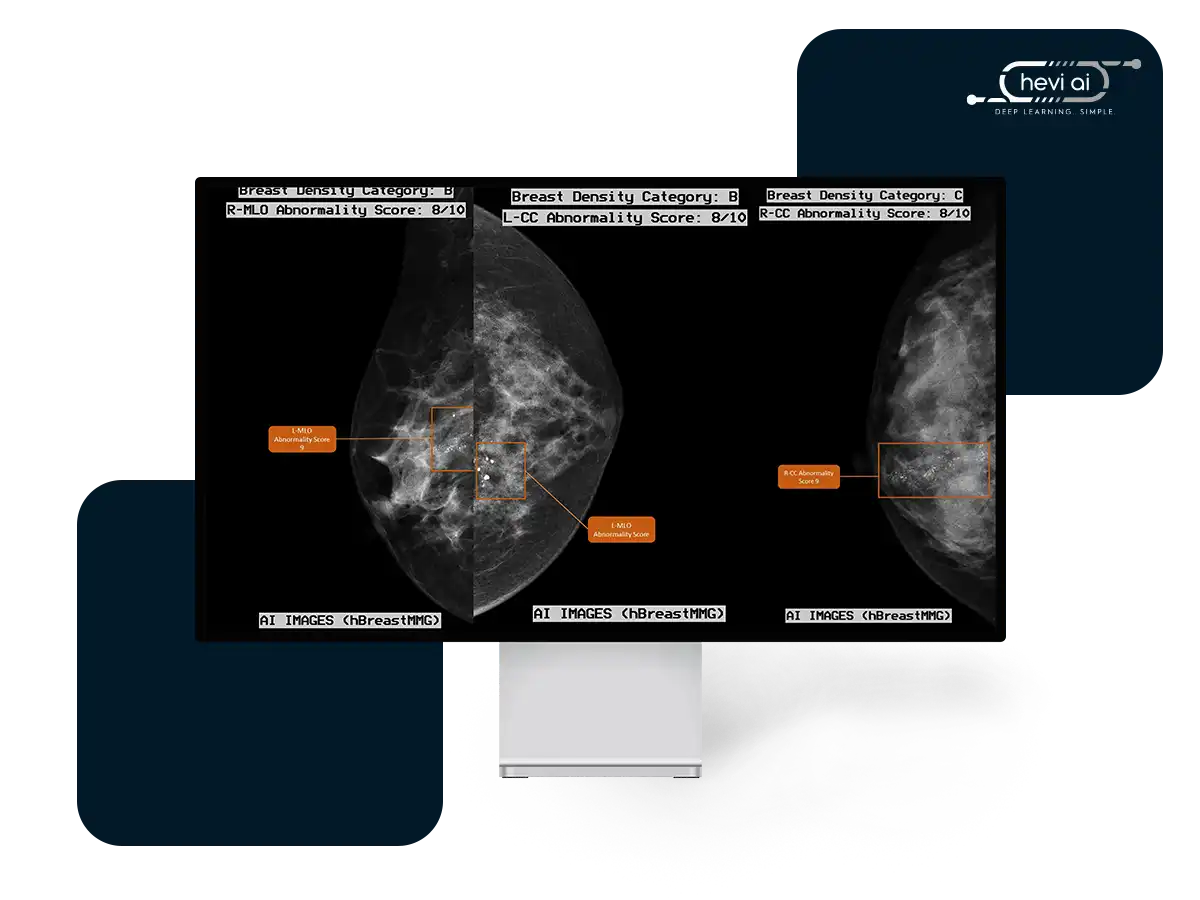 hBreastMMG product feature